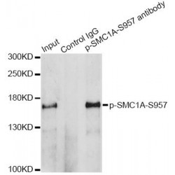 SMC1A (pS957) Antibody