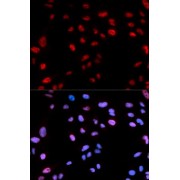 Immunofluorescence analysis of U2OS cells using Phospho-Histone H3-T11 antibody (abx000163). Blue: DAPI for nuclear staining.