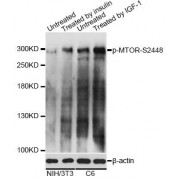 Western blot analysis of extracts of NIH/3T3 and C6 cells, using Phospho-MTOR-S2448 antibody (abx000164) at 1/2000 dilution. NIH/3T3 cells were treated by Insulin (100nM) for 10 minutes after serum-starvation overnight. C6 cells were treated by IGF-1 (50 ng/ml) for 30 minutes after serum-starvation overnight.