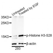 Western blot analysis of extracts of 293T cells, using Phospho-Histone H3-S28 antibody (abx000165) at 1/1000 dilution. 293T cells were treated by EGF (25 µg/ml) for 30 minutes after serum-starvation overnight.