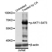 Western blot analysis of extracts of Jurkat cells,using Phospho-AKT1-S473 antibody (abx000166) at 1/2000 dilution. Jurkat cells were treated by Calyculin A (100nM) for 30 minutes.