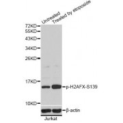 Western blot analysis of extracts of Jurkat cells, using Phospho-H2AFX-S139 antibody (abx000167). Jurkat cells were treated by etoposide.