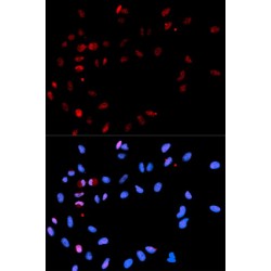 Histone H2A.x (pS139) Antibody