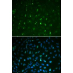 Histone H2A.x (pS139) Antibody