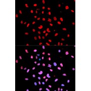 Immunofluorescence analysis of U2OS cells using Phospho-Btk-Y223 antibody (abx000168). Blue: DAPI for nuclear staining.