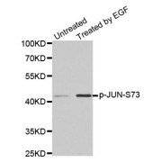 Western blot analysis of extracts from PC14 cells using phospho-JUN-S73 antibody (abx000171).