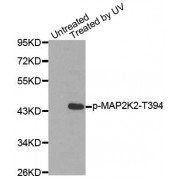 Western blot analysis of extracts from HepG2 cells using Phospho-MAP2K2-T394 antibody (abx000173).