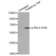 Western blot analysis of extracts from HepG2 cells using Phospho-RELA-S536 antibody (abx000176).