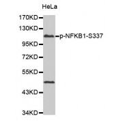 Western blot analysis of extracts of HeLa cells, using Phospho-NFKB1-S337 antibody (abx000177).