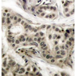 NFKB1 (pS337) Antibody