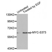 Western blot analysis of extracts from A431 cells using Phospho-MYC-S373 antibody (abx000184).