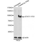 Western blot analysis of extracts of HeLa cells, using Phospho-STAT1-Y701 antibody (abx000187) at 1/1000 dilution. HeLa cells were treated by IFN-α (100ng/ml) for 30 minutes after serum-starvation overnight.