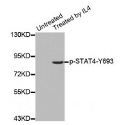 Western blot analysis of extracts from HepG2 cells using Phospho-STAT4-Y693 antibody (abx000189).