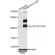 Western blot analysis of extracts of K562 cells, using Phospho-STAT5A-Y694 antibody (abx000190) at 1/2000 dilution. K562 cells were treated by G-CSF (25ng/ml) for 30 minutes after serum-starvation overnight.