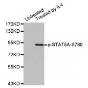 Western blot analysis of extracts from K562 cells using Phospho-STAT5A-S780 antibody (abx000191).