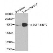 Western blot analysis of extracts from HUVEC cells, using phospho-EGFR-S1070 antibody (abx000205).