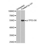 Western blot analysis of extracts from HeLa cells, using phospho-TP53-S6 antibody (abx000209).