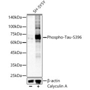 Western blot analysis of SH-SY5Y extracts, using phospho-MAPT-S396 antibody (1/1000 dilution).