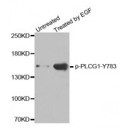 Western blot analysis of extracts from HL60 cells, using phospho-PLCG1-Y783 antibody (abx000216).
