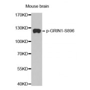 Western blot analysis of extracts from mouse Brain tissue, using phospho-GRIN1-S896 antibody (abx000217).