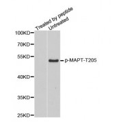Western blot analysis of extracts from mouse brain tissue, using phospho-MAPT-T205 antibody (abx000220).