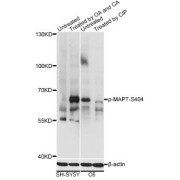 Western blot analysis of extracts of SH-SY5Y and C6 cells, using Phospho-MAPT-S404 antibody (abx000222) at 1/2000 dilution. SH-SY5Y cells were treated by Okadaic Acid (100nM) for 1 hour and Calyculin A (100nM) for 30 minutes after serum-starvation overnight.C6 cell lysates were treated by CIP at 37°C for 1 hour.