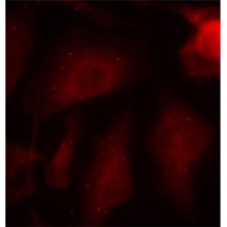 Microtubule-Associated Protein Tau Phospho-Ser404 (MAPT pS404) Antibody