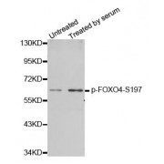 Western blot analysis of extracts from 293 cells using phospho-FOXO4-S197 antibody (abx000229).