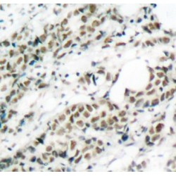 FOXO4 (pS197) Antibody