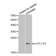 Western blot analysis of extracts from COLO205 cells, using phospho-CFL1-S3 antibody (abx000230).