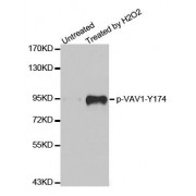 Western blot analysis of extracts from Jurkat cells,using phospho-VAV1-Y174 antibody (abx000232).