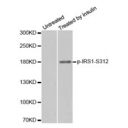 Western blot analysis of extract from 293 cells, using phospho-IRS1-S312 antibody (abx000233).