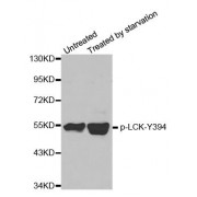 Western blot analysis of extracts from JK cells, using phospho-LCK-Y394 polyclonal antibody (abx000234).