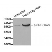 Western blot analysis of extracts from HT29 cells, using Phospho-SRC-Y529 antibody (abx000237).