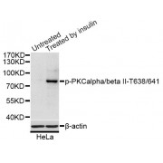 Western blot analysis of extracts of HeLa cells, using Phospho-PRKCB-T641 antibody (abx000243) at 1/1000 dilution. HeLa cells were treated by Insulin (0.01U/ml) for 15 minutes after serum-starvation overnight.