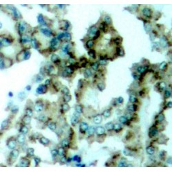 PRKCB (pT641) Antibody