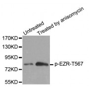 Western blot analysis of extracts from MDA cells, using Phospho-EZR-T567 antibody (abx000259).