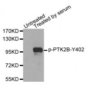 Western blot analysis of extracts from 293 cells, using Phospho-PTK2B-Y402 antibody (abx000266).