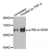 Western blot analysis of extracts from 293 cells, using Phospho-RELA-S529 antibody (abx000267).