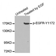 Western blot analysis of extracts from A431 cells, using Phospho-EGFR-Y1172 antibody (abx000270).