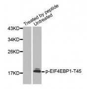 Western blot analysis of extracts from HeLa cells using Phospho-EIF4EBP1-T45 antibody (abx000271).