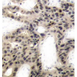 EIF4EBP1 (pT45) Antibody