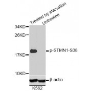 Western blot analysis of extracts of K-562 cells, using Phospho-STMN1-S38 antibody (abx000273). K562 cells were treated by serum-starvation overnight.