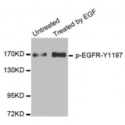 Western blot analysis of extracts from HUVEC cells, using Phospho-EGFR-Y1197 antibody (abx000275).