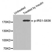 Western blot analysis of extracts from 3T3 cells, using Phospho-IRS1-S636 antibody (abx000277).