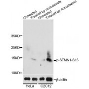 Western blot analysis of extracts of HeLa and C2C12 cells, using Phospho-STMN1-S16 antibody (abx000281) at 1/2000 dilution. HeLa cells were treated by Nocodazole (50ng/ml) for 20 hours.C2C12 cells were treated by Nocodazole (50ng/ml) for 20 hours.