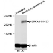 Western blot analysis of extracts of HT-29 cells,using Phospho-BRCA1-S1423 antibody (abx000284) at 1/2000 dilution. HT-29 cells were treated by Anisomycin (5 µg/ml) for 30 minutes after serum-starvation overnight.