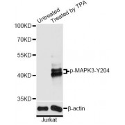 Western blot analysis of extracts of Jurkat cells, using Phospho-MAPK3-Y204 antibody (abx000287) at 1/2000 dilution. Jurkat cells were treated by PMA/TPA (200nM) for 10 minutes.