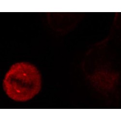 Mitogen-Activated Protein Kinase 3 Phospho-Tyr204 (MAPK3 pY204) Antibody