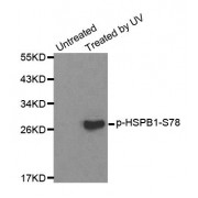 Western blot analysis of extracts from HL60 cells, using Phospho-HSPB1-S78 antibody (abx000288).